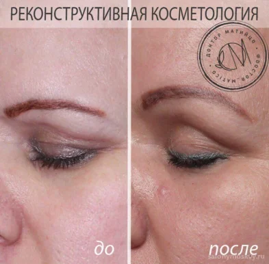 Клиника косметолога-эксперта Ольги Матийцо фото 4